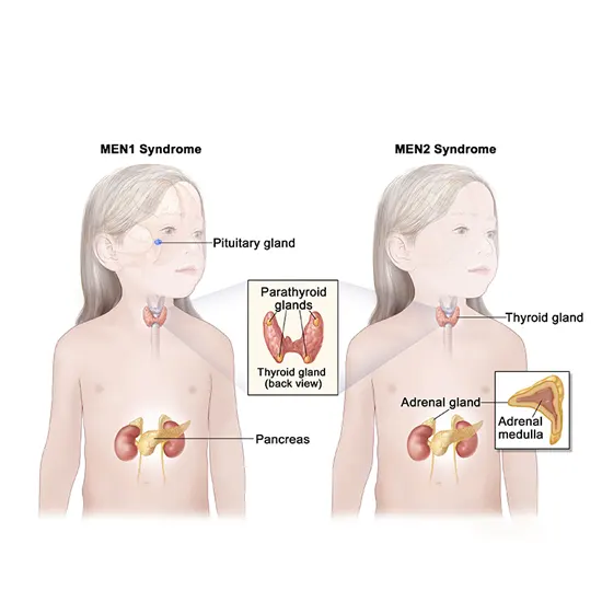 multiple endocrine neoplasia syndrome package test